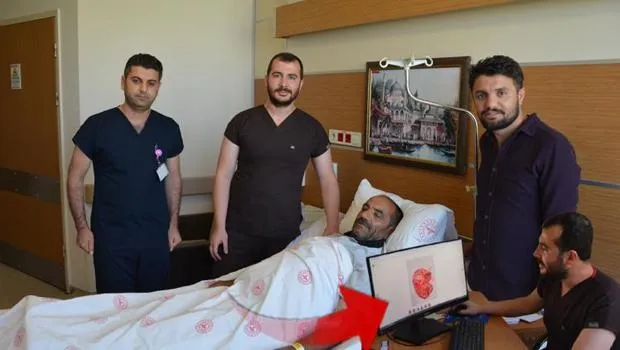 Karnındaki Şişlik Şoke Etti! Doktorlar Bile İnanamadı!