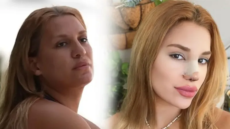 Survivor'dan sonra çok değişti! Almeda Baylan'dan şaşırtan karar!
